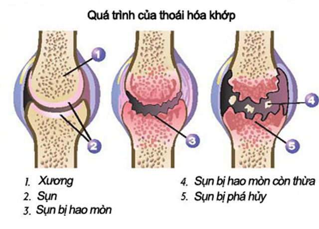 Qua Trinh Thoa Hoa Khop